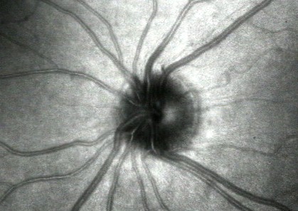 retina print